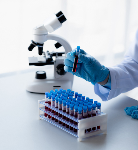 Lab Kinx Testing Water Testing – LAB KinX